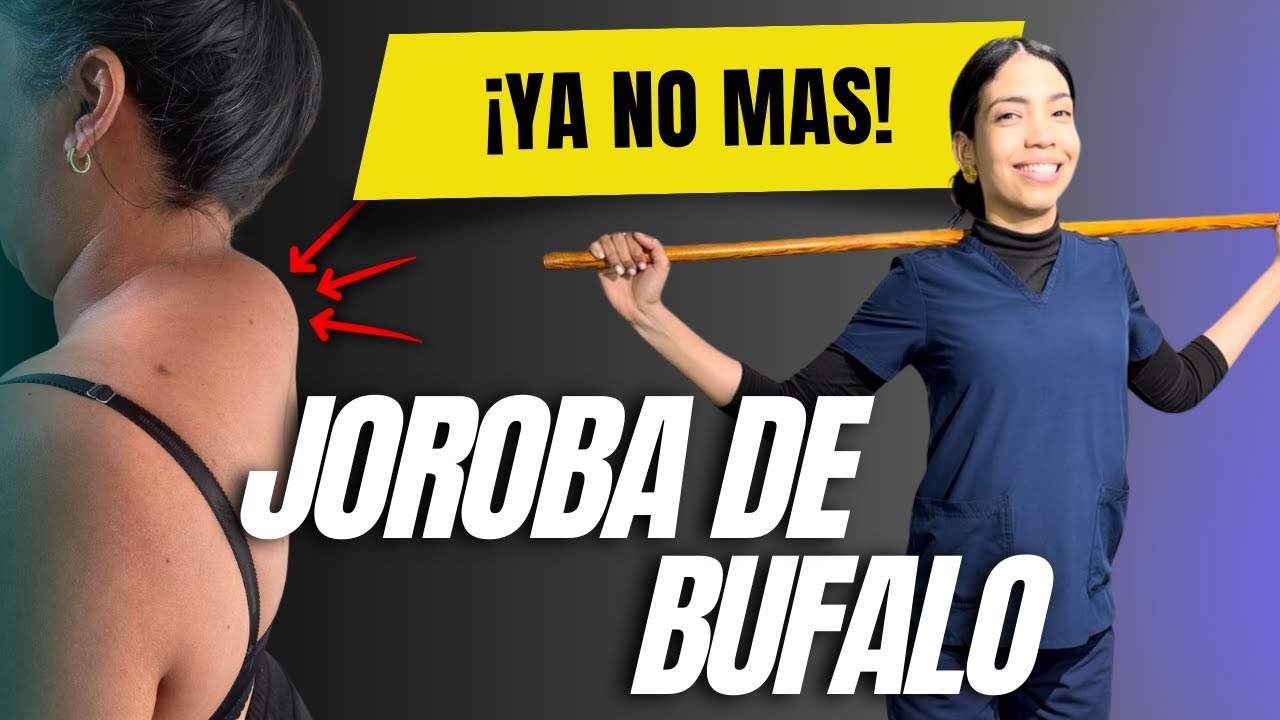“Cómo eliminar la JOROBA de BÚFALO rápido 😱 | 6 ejercicios efectivos en casa”#saludpostural