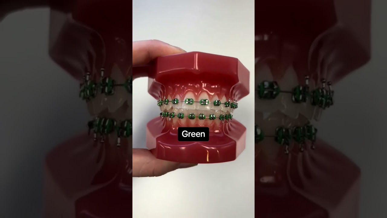 اجمل ألوان تقويم الاسنان😱🦷