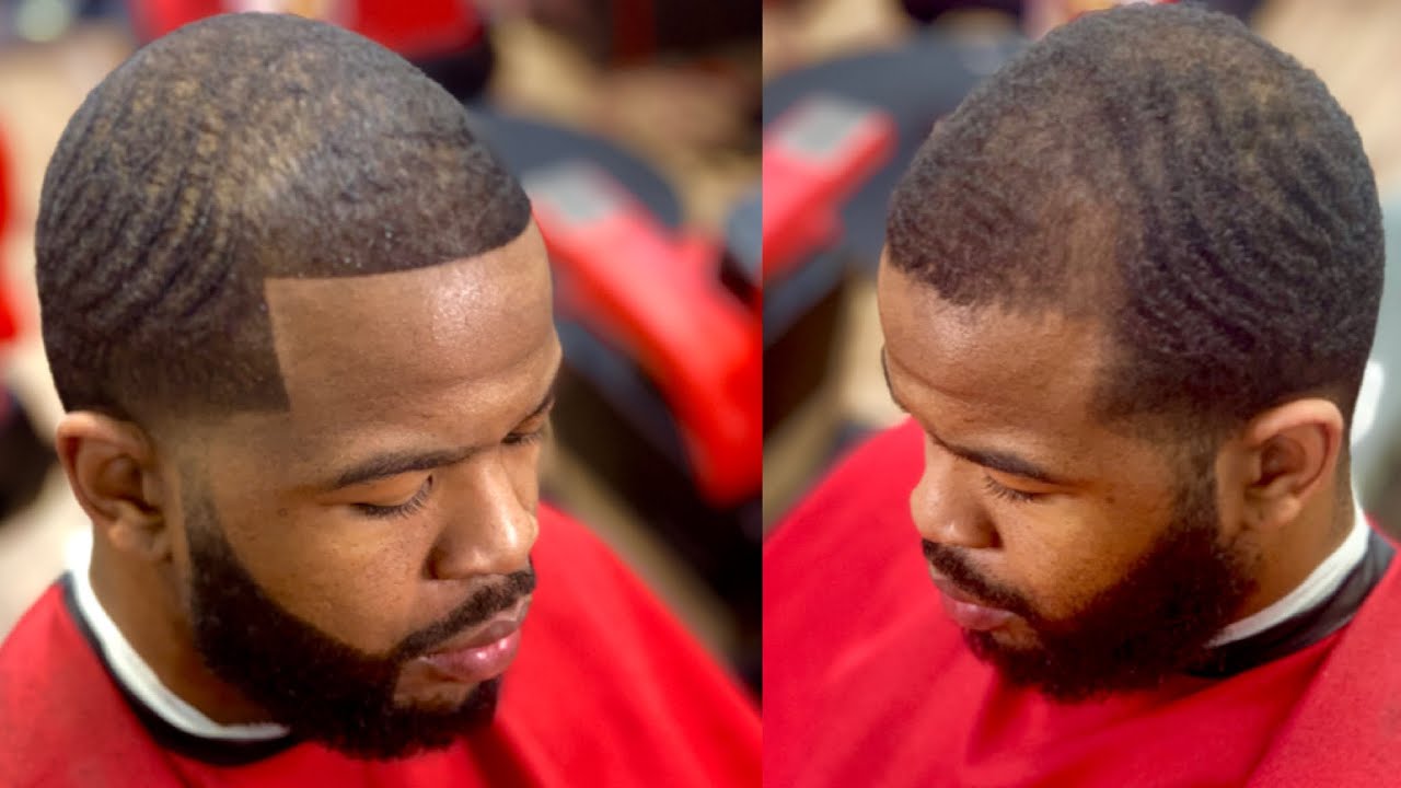 Receding hairline | Hair Fiber
