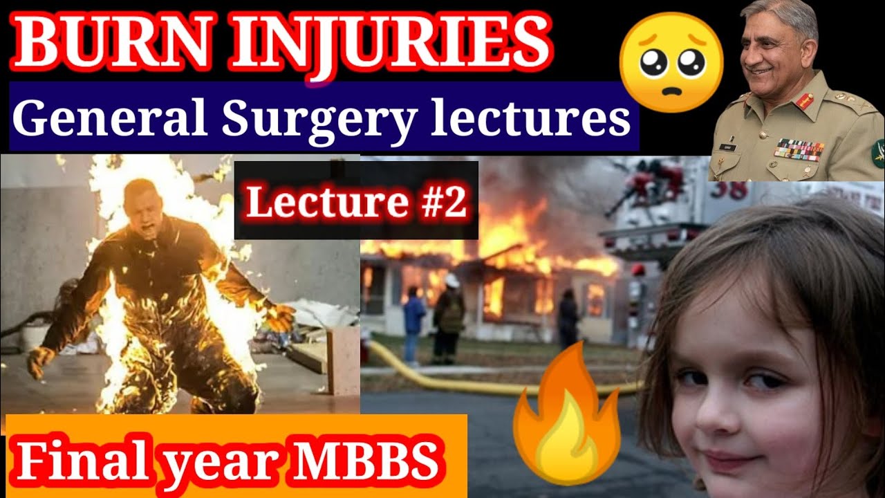 Burn injury. General surgery lecture #2 . Final year MBBS #SURGERY #BURN classification rule of nine