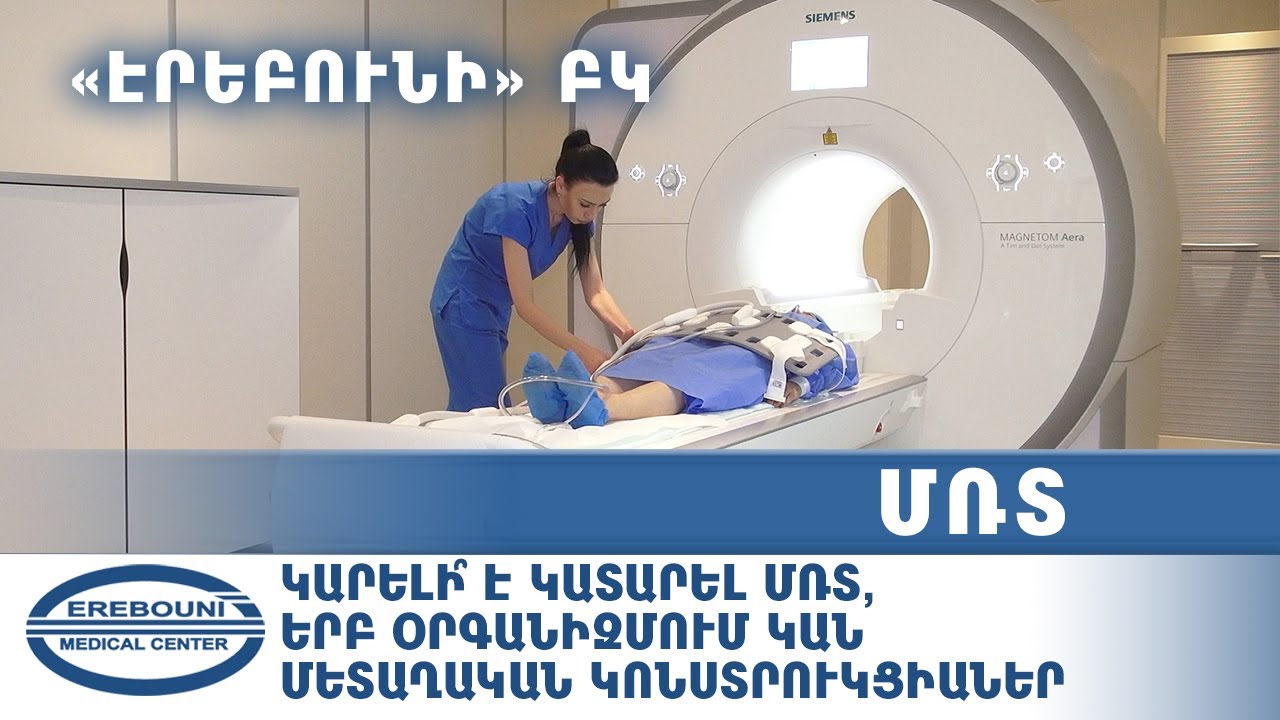 ՄՌՏ.  կարելի՞ է կատարել ՄՌՏ, երբ օրգանիզմում կան մետաղական կոնստրուկցիաներ (Էրեբունի ԲԿ)