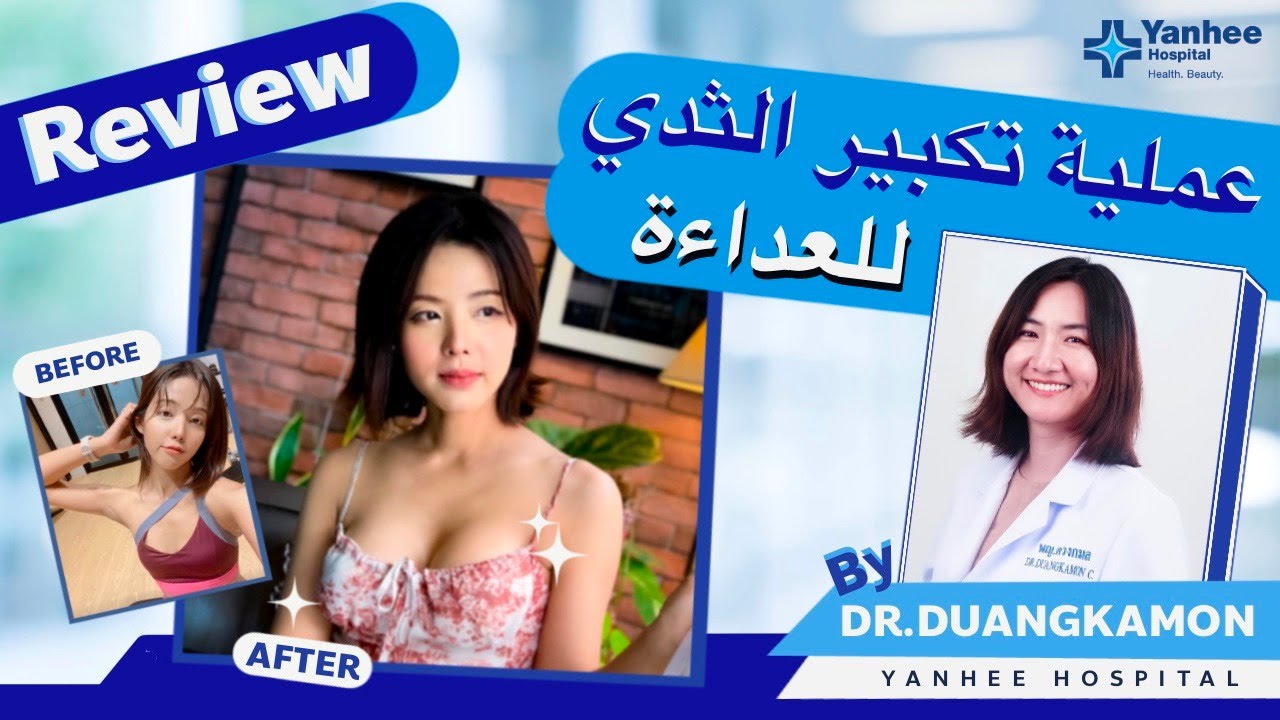 عملية تكبير الثدى للعداءة