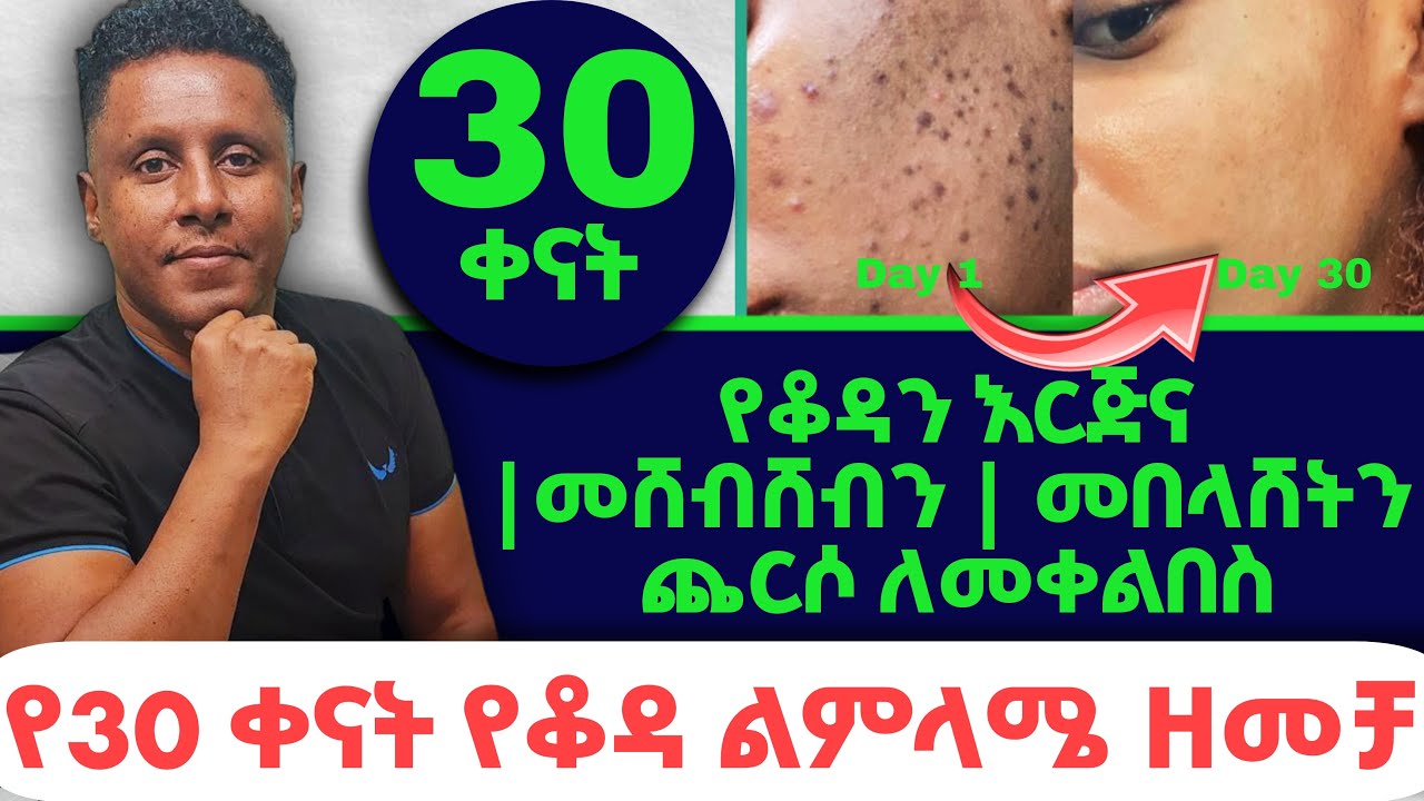 Ethiopia | #የቆዳን እርጅና | #በሸብሸብን | #መበላሸትን ጨርሶ ልመቀልበስ | የ30 ቀናት የቆዳ ልምላሜ ዘመቻ