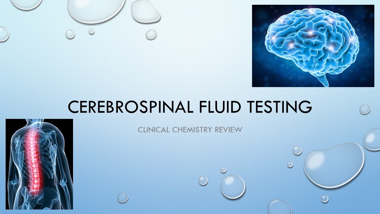 CSF testing