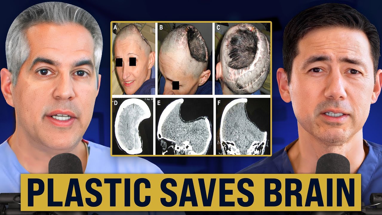 How Plastic Surgery Saves Brain Surgery Patients