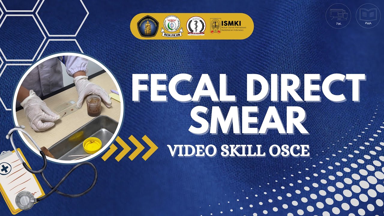[VIDEO SKILL OSCE - FECAL DIRECT SMEAR]
