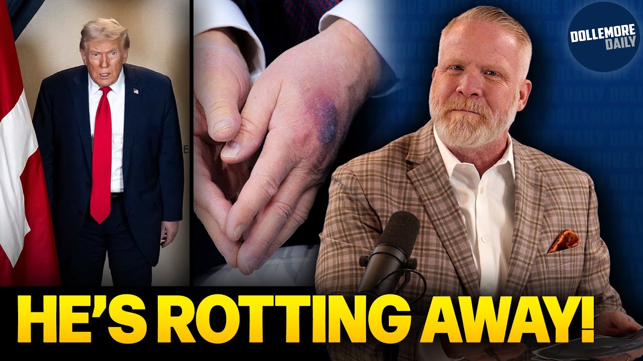 Donald Trump&rsquo;s IMPENDING DEATH TAKES CENTER STAGE at Davos Meeting!!!