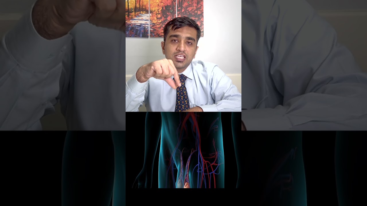 Varicocele क्या होता है और क्यू होते है? | What is VARICOCELE