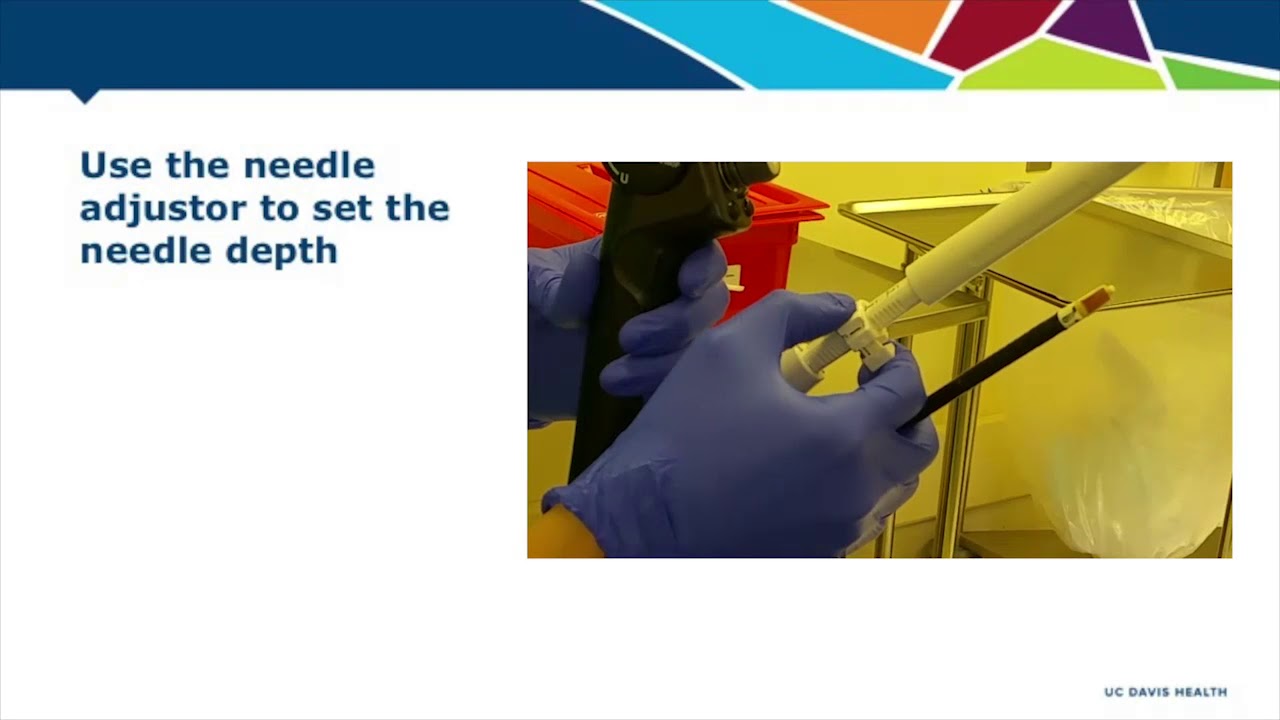 Asvide: Endobronchial ultrasound-guided transbronchial needle aspiration for squamous cell carcinoma