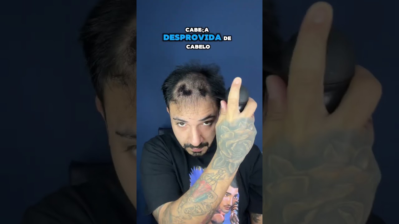 Fibra capilar milagre dos calvos