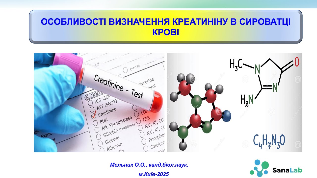 Особливості визначення креатиніну в сироватці крові
