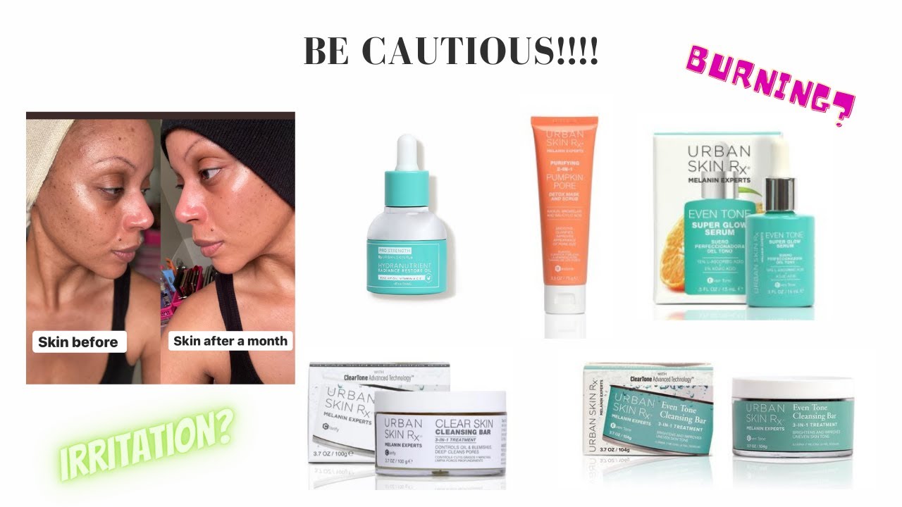 Urban Skin Rx - Amazing results but at what cost!?!