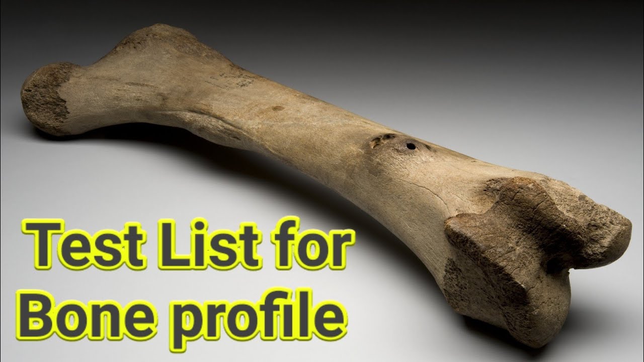 Bone profile or test list for bone