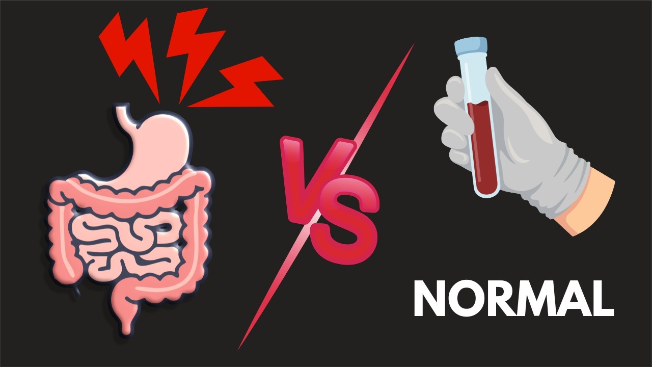 Hidden Allergies that Live Only In Your Gut/ Nose/ Eyes (Local IgE Mediated)