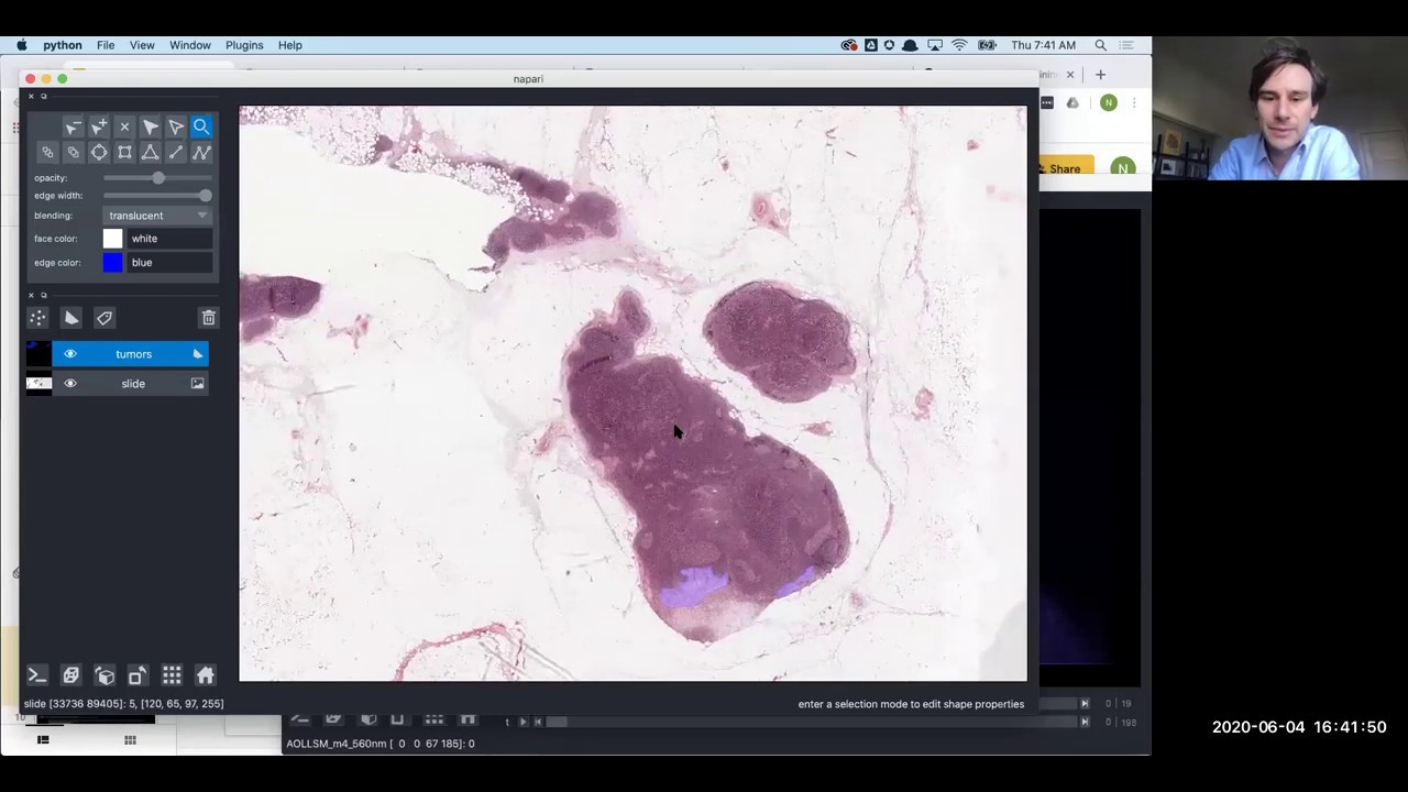 Multi-dimensional image visualization in Python using napari [NEUBIAS Academy@Home] webinar
