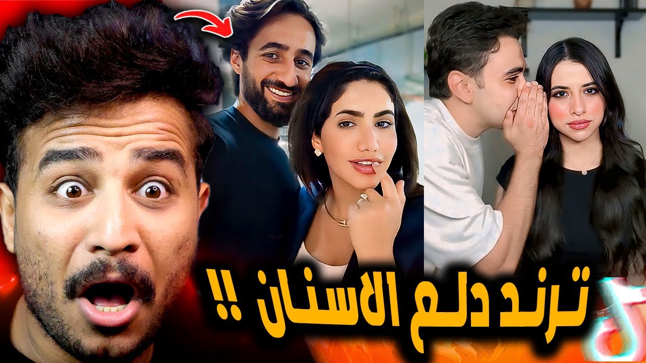 ترند دلع الاسنان المسوسه والترندات دي غريبه 😂!!