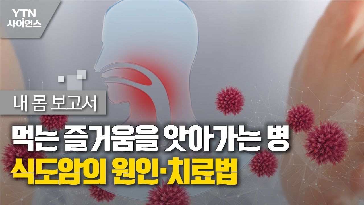 [내 몸 보고서] 먹는 즐거움을 앗아가는 병…식도암의 원인·치료법 / YTN 사이언스