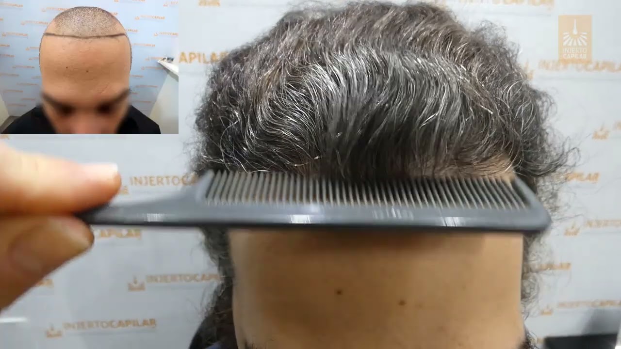 Restauracion de entradas con 2000 Uf