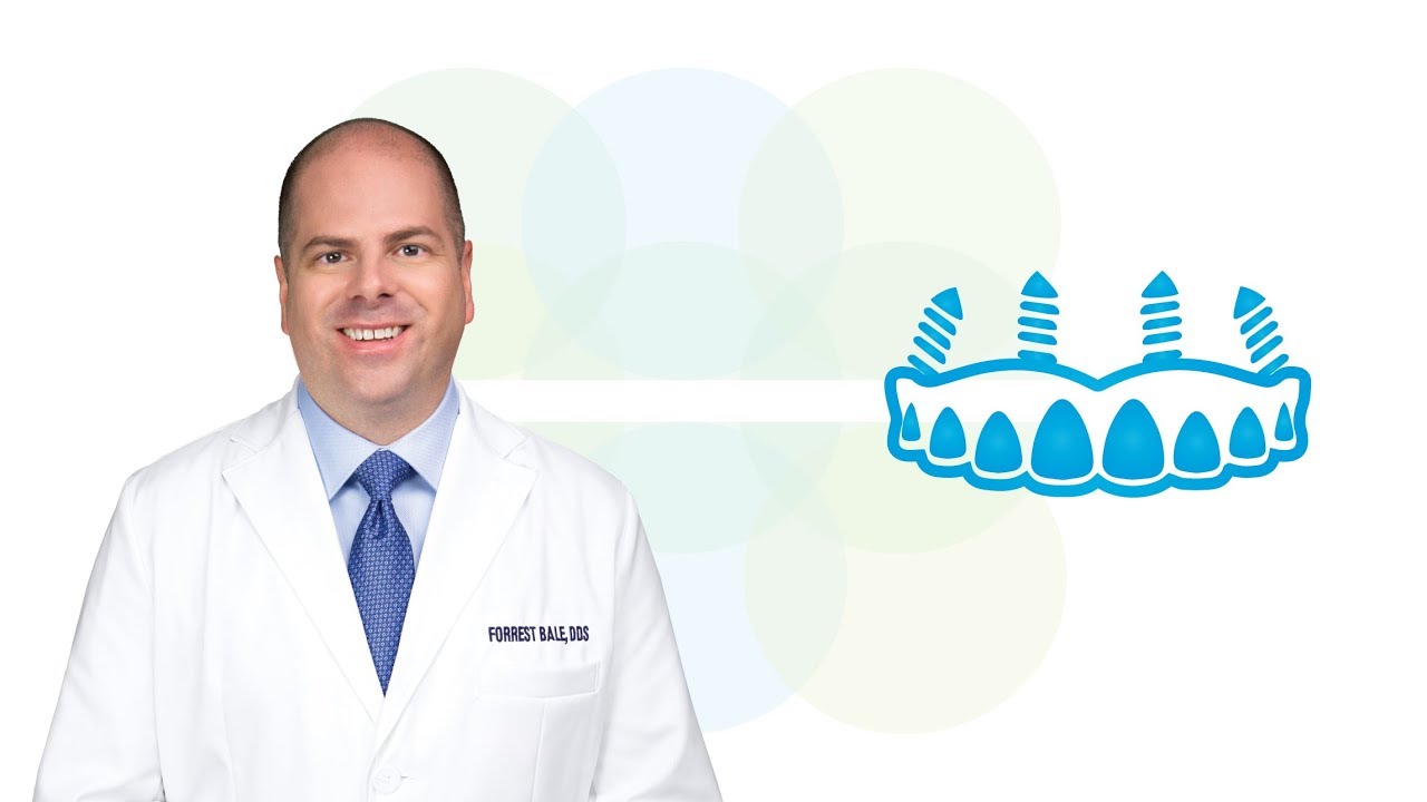 Full-Arch Restoration in Russellville AR | Lakeside Oral, Facial and Dental Implant Surgery