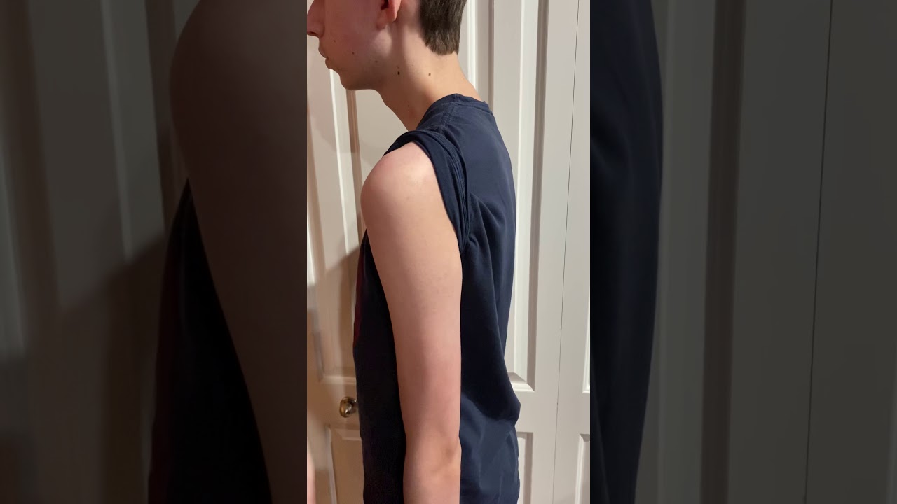 Palpation of humerus and scapula