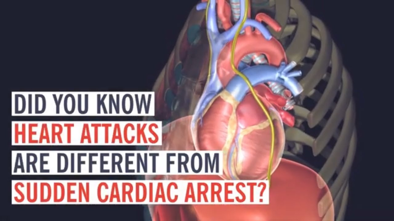 The Difference Between a Heart Attack and Cardiac Arrest