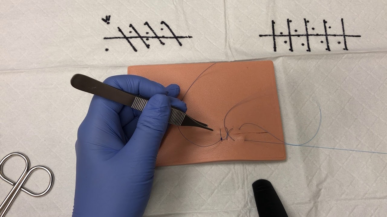 Locked Running Suture