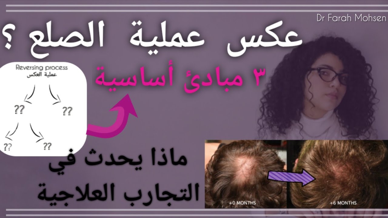 المبدأ الأساسي لعملية عكس الصلع ..نجاح الباحثين غير المتخصصين مع الحالات الاولية للصلع.. و الطريقة ؟