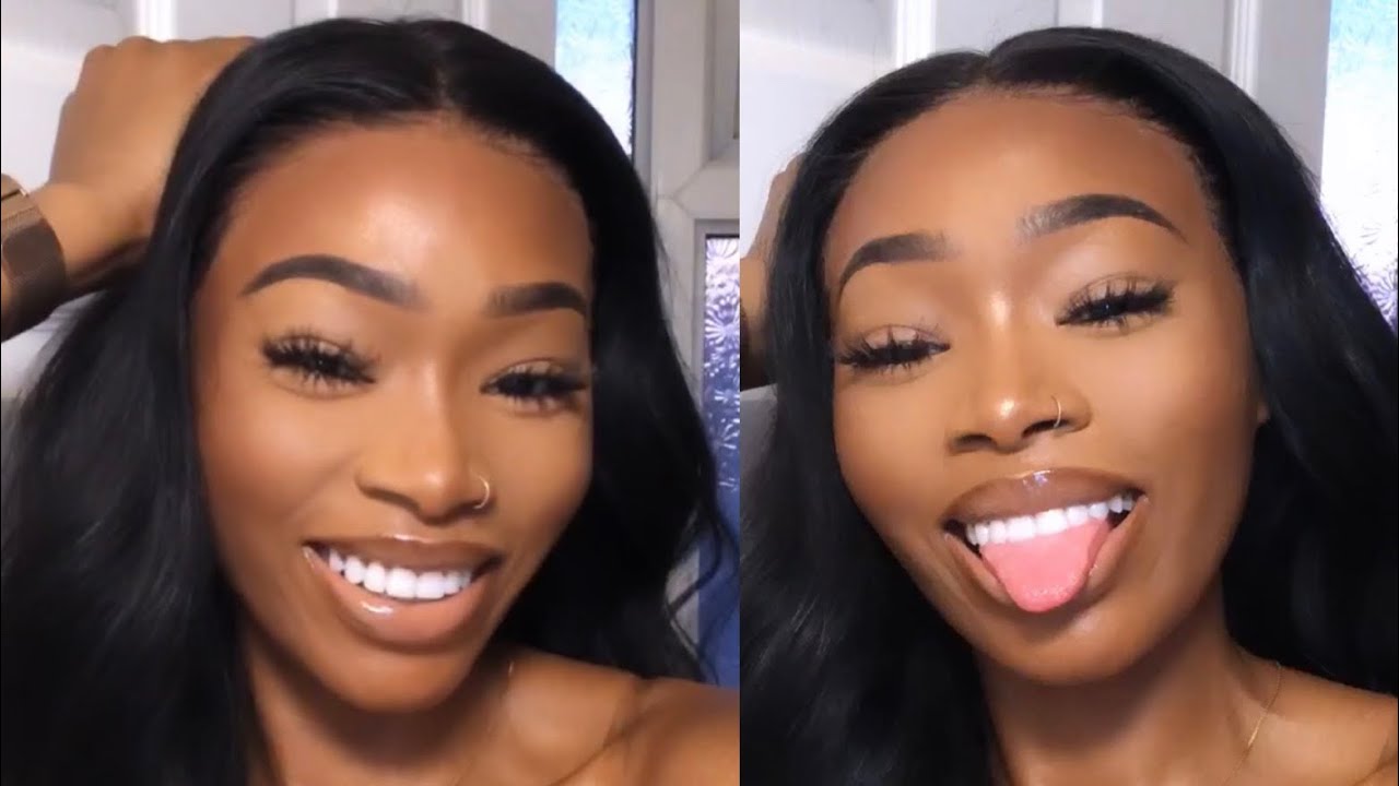 TEETH JOURNEY: Invisalign, Whitening, Gum Lasering & Composite Bonding