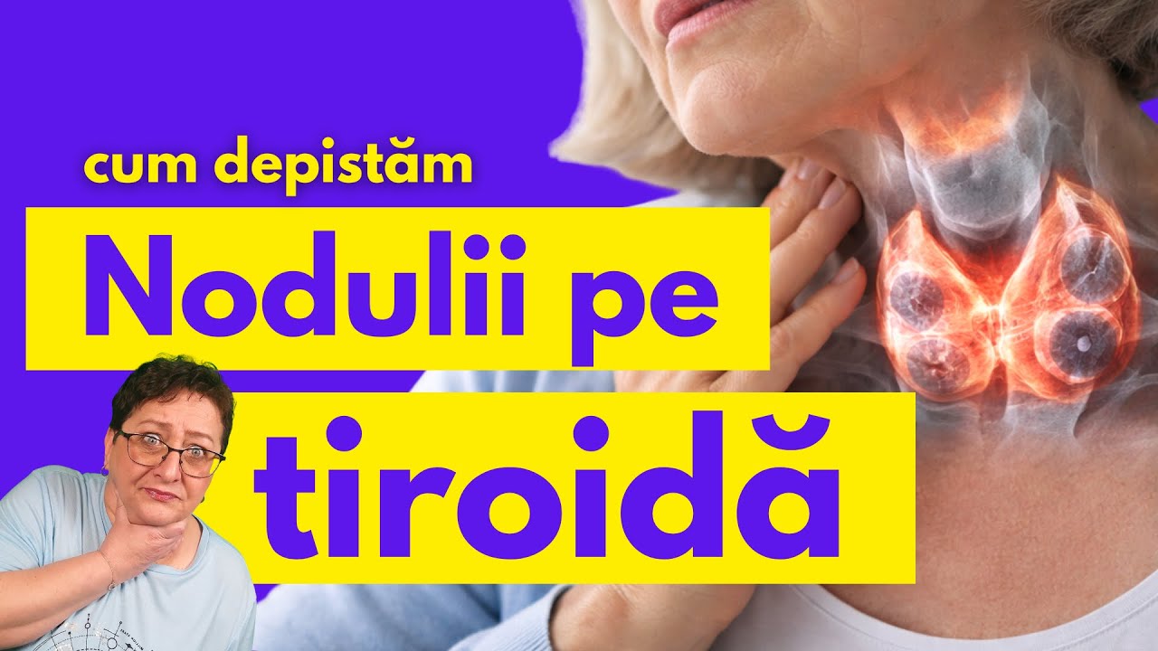 Cum știi dacă ai NODULI pe Glanda Tiroidă + când este CANCER