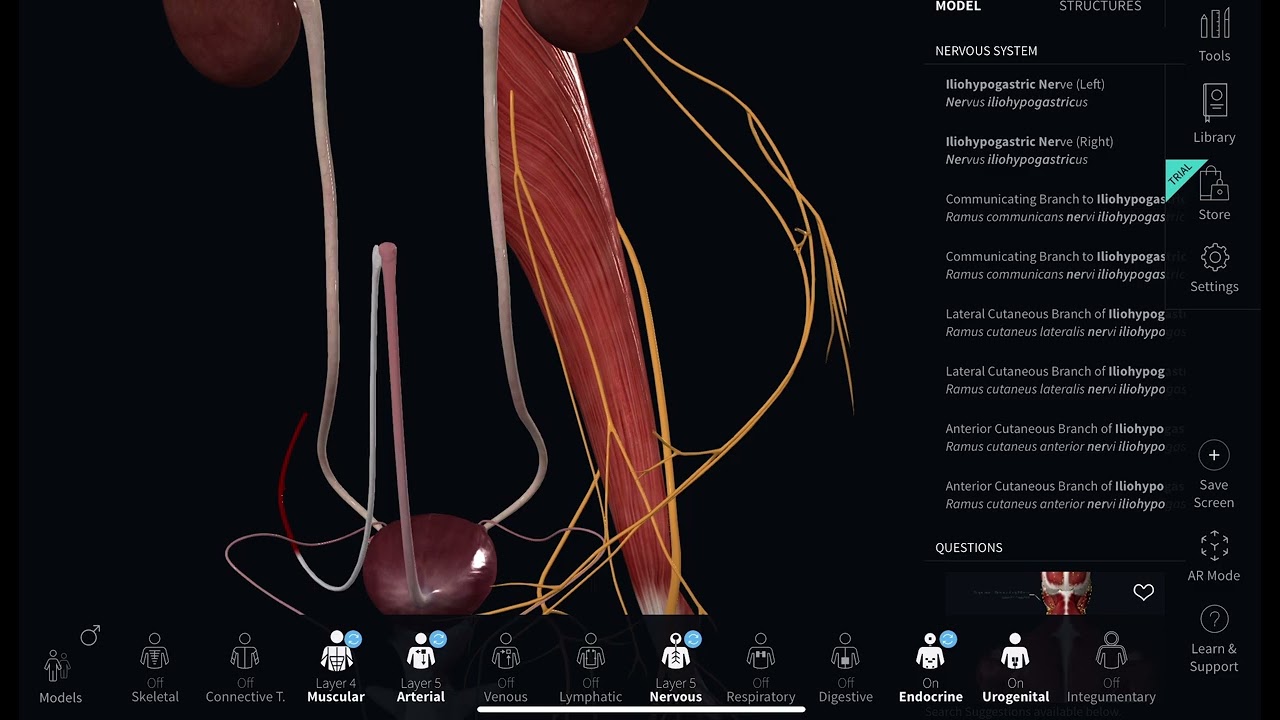 Anatomical complication of psoas hitch 