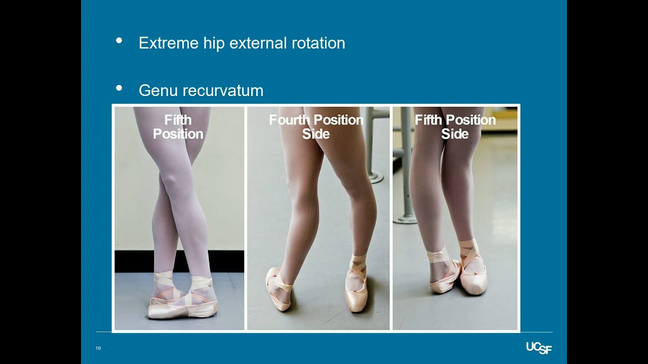Dance Medicine: Grace Under Pressure - Kristin Wingfield, MD