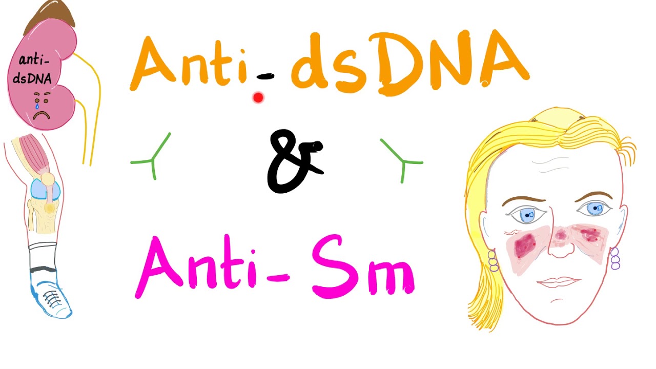 Anti-dsDNA vs Anti-Smith Antibodies