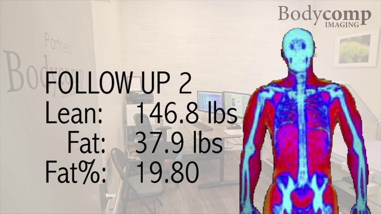 Bodycomp Imaging White Rock demonstration