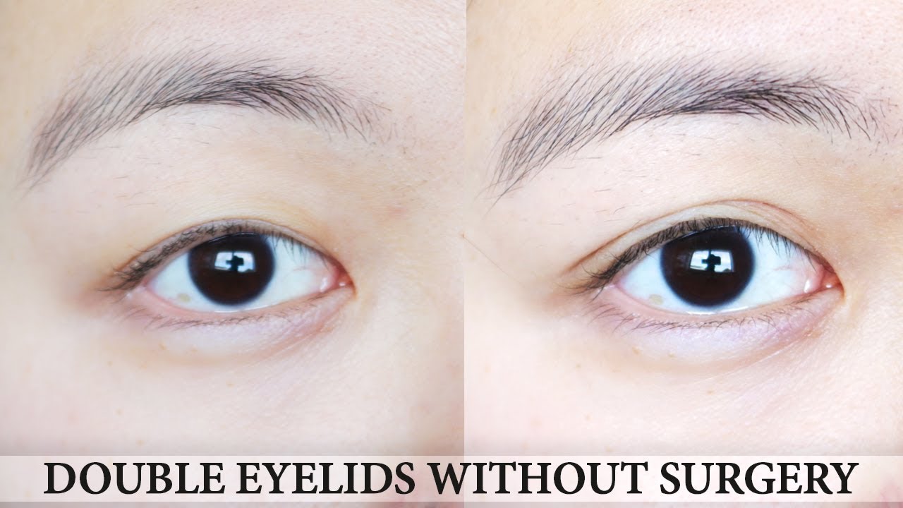 How To Get Double Eyelid Without Surgery | D-UP Wonder Eyelid Tape