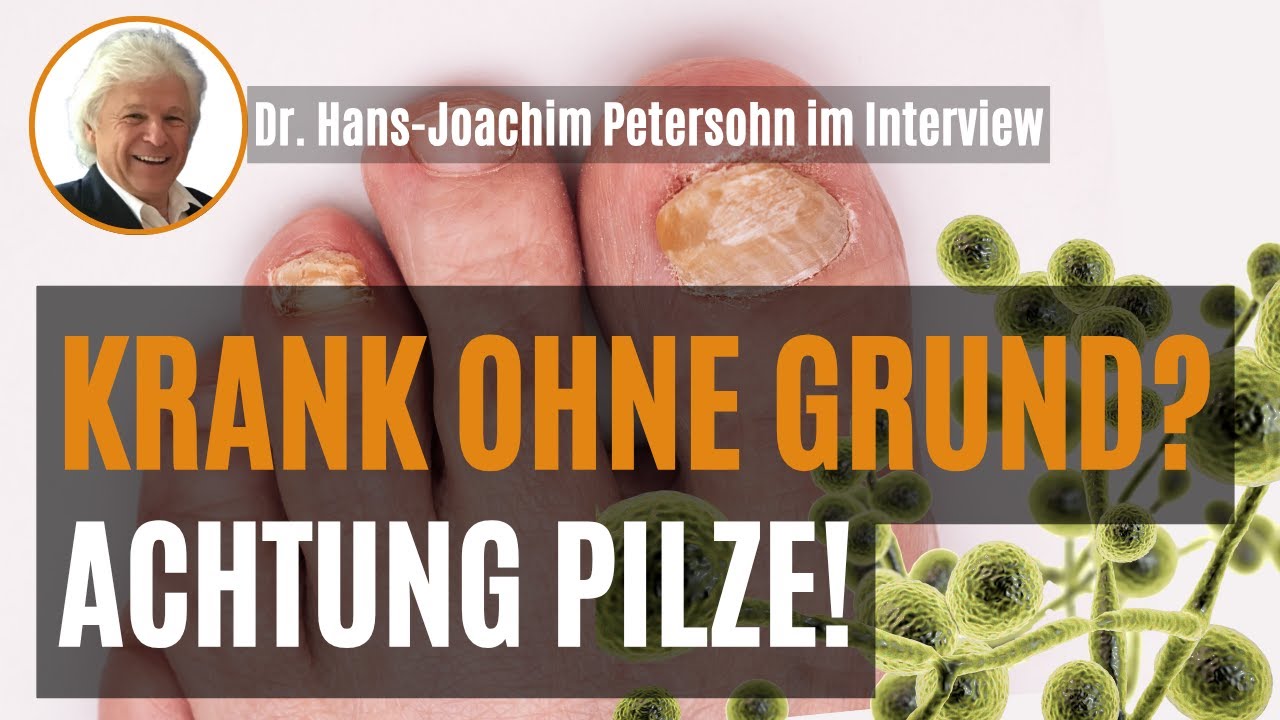Krank ohne Grund? Checke das - Pilzinfektionen stecken oft dahinter!