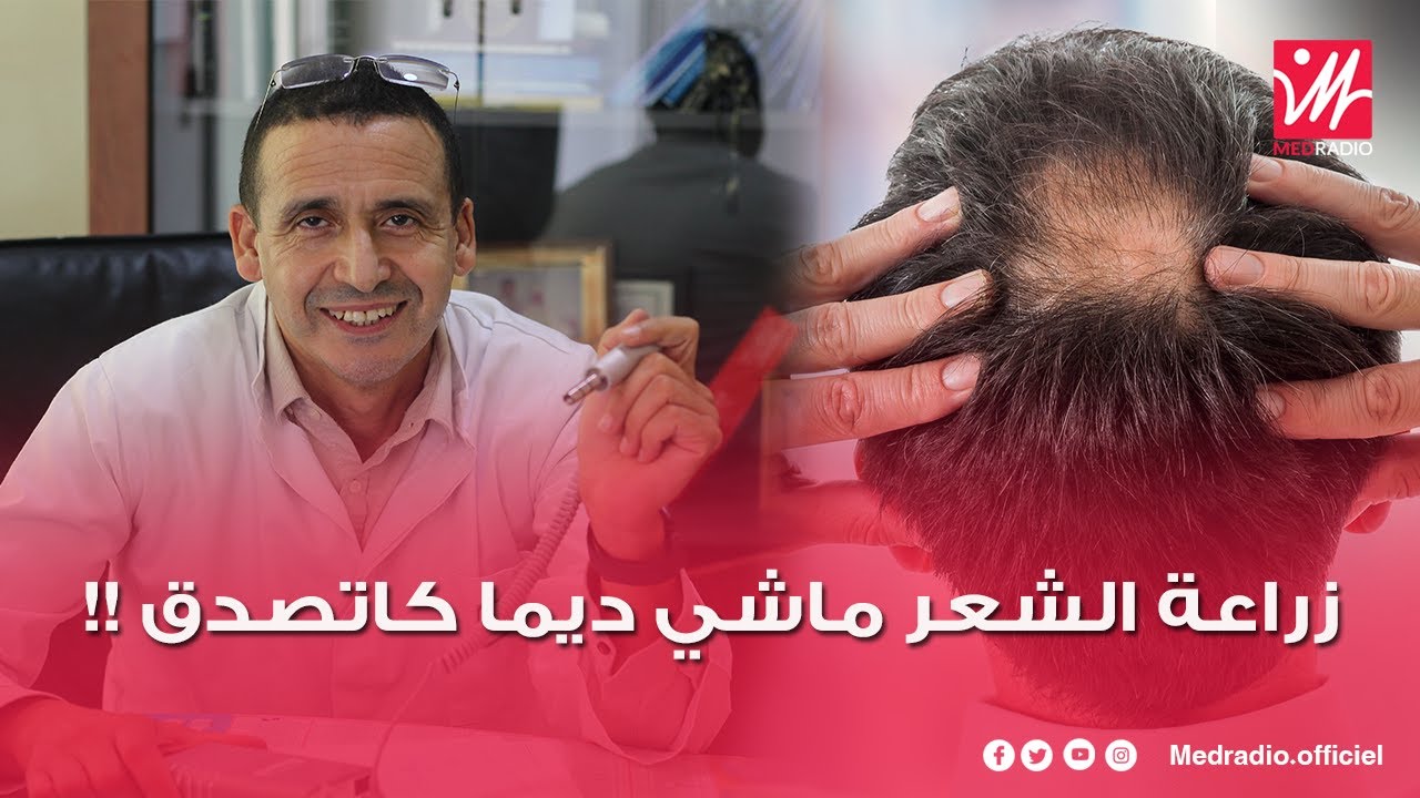 إقبال المغاربة على زراعة الشعر/ متى تكون غير مجدية؟/ سبب غلاء الأسعار؟.. الدكتور المرتقي يجيب