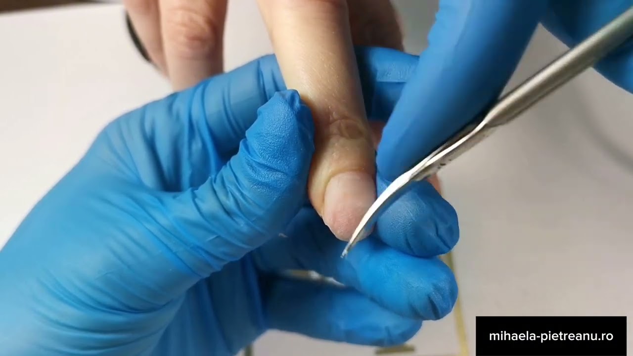 Extensii Cu Tipsuri Reutilizabile Unghii Problematice