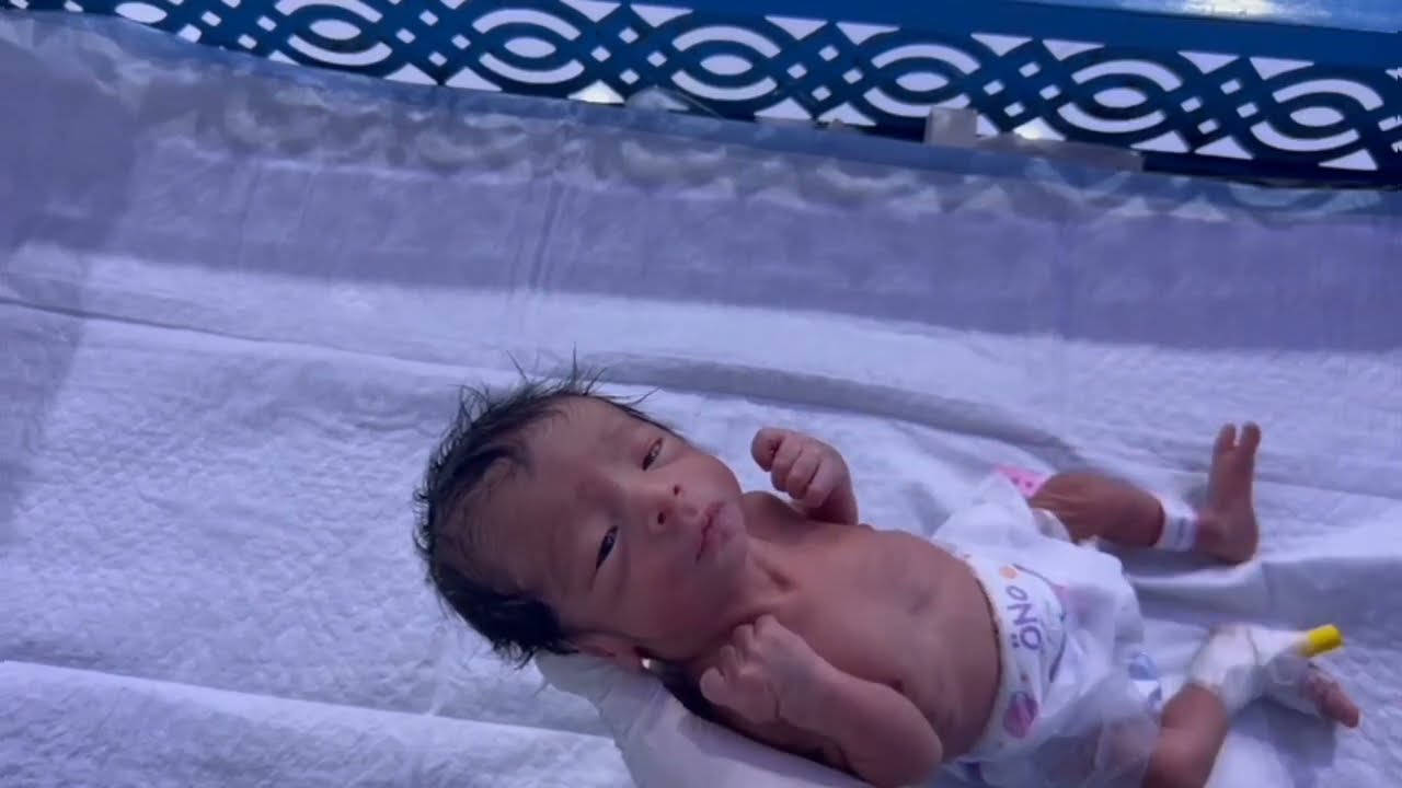 29 Week Premature Baby Part 2  Feeding Well NICU Progress Update 👶