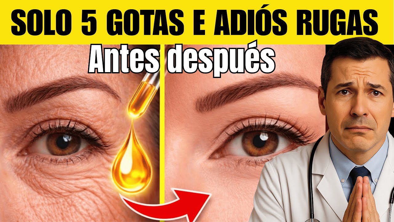 Dermatólogo revela : “QUITA TUS ARRUGAS Con EL MEJOR ACEITE DE CASA NATURAL”