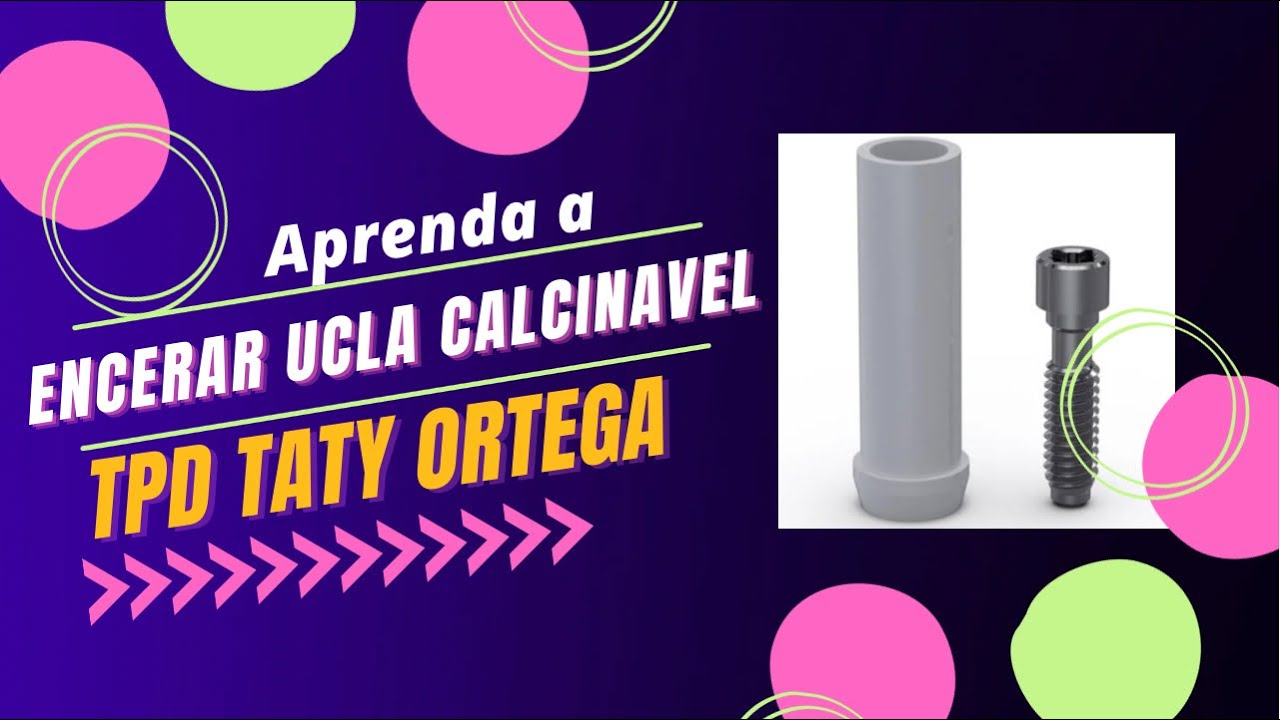 Como encerar ucla calcinavel 4.1 hexágono externo anti-rotacional