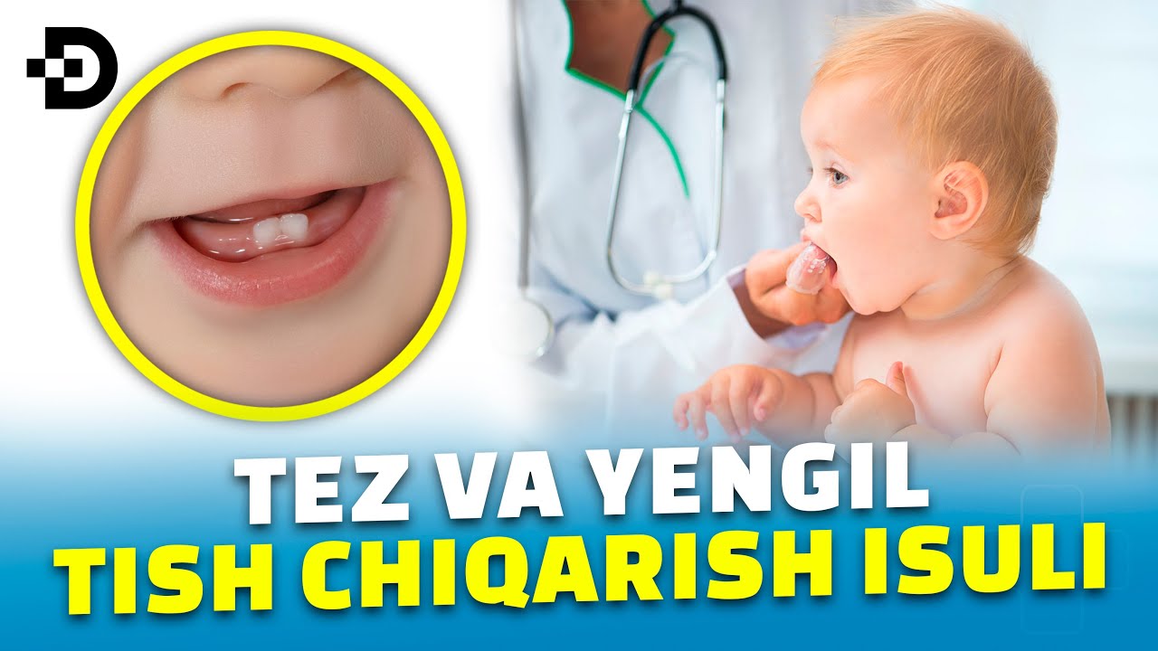 БОЛАЛАРДА ТЕЗ ТИШ ЧИҚАРИШ УСУЛИ, УЙ ШАРОИТИДА ТИШ ЧИҚАРИШ