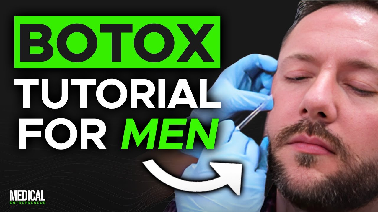 Botox Injection Patterns for Men | Full Procedure Demonstration