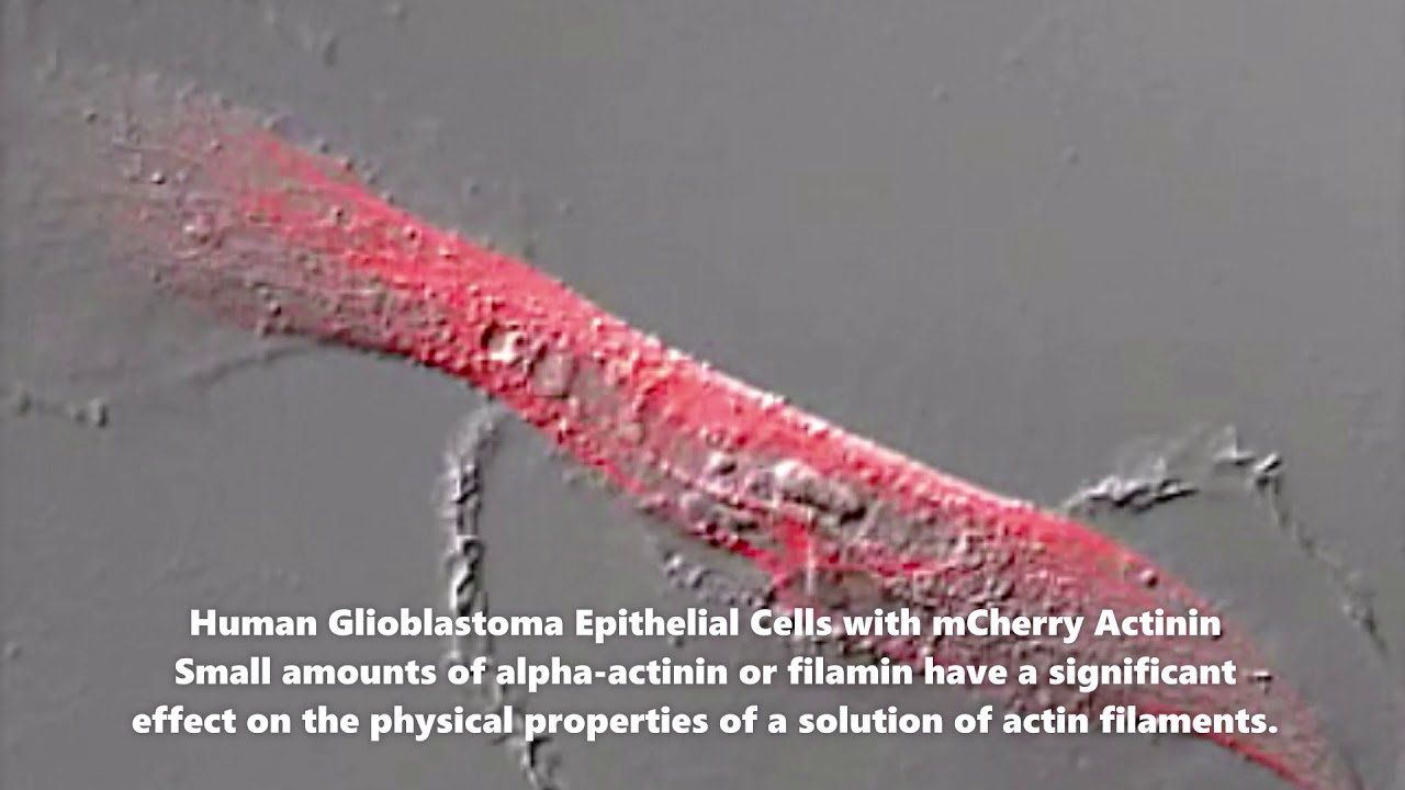 Human Glyoblastoma Epithelial Cells with mCherry Actinin