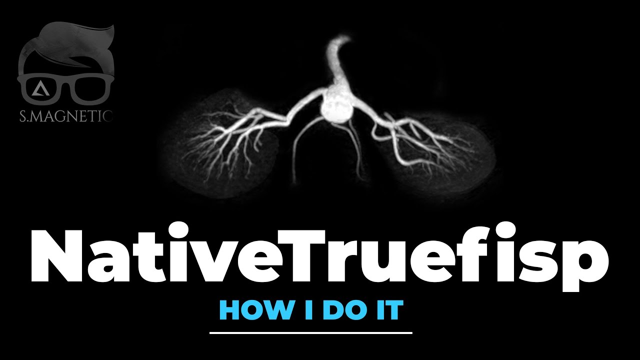 NativeTruefisp – «КАК Я ЭТО ДЕЛАЮ»