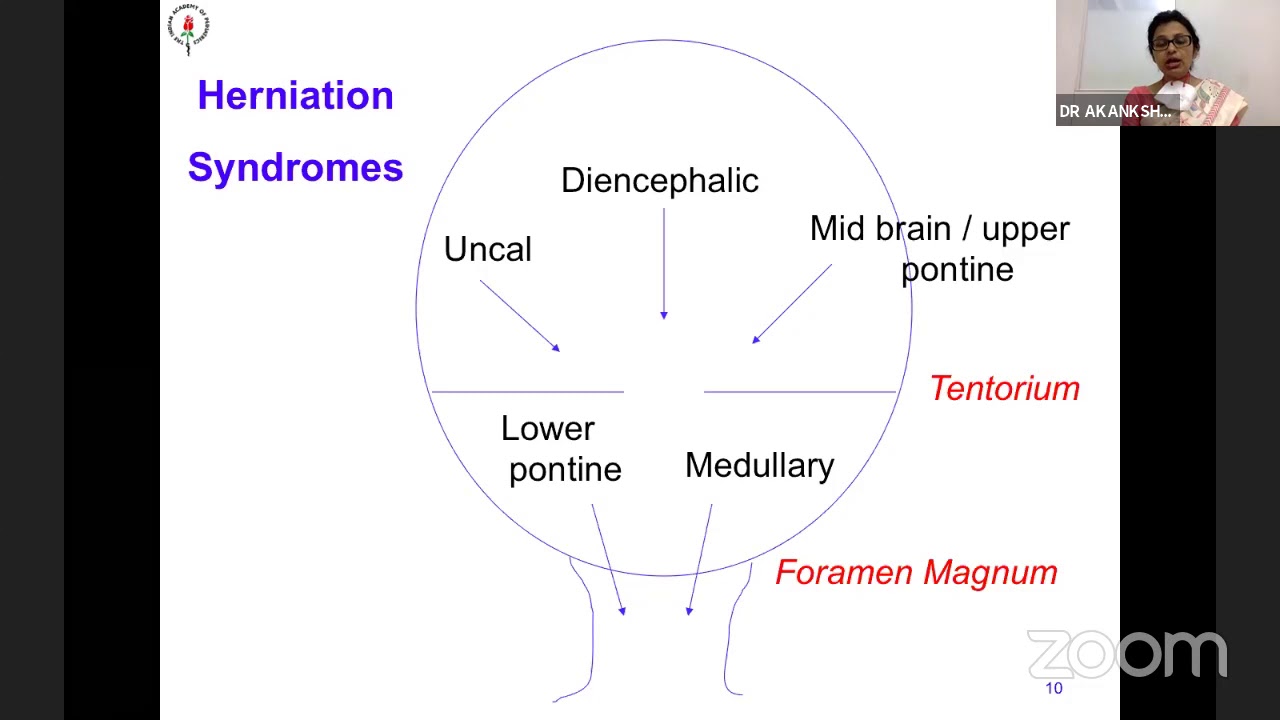 Approach to Altered Sensorium