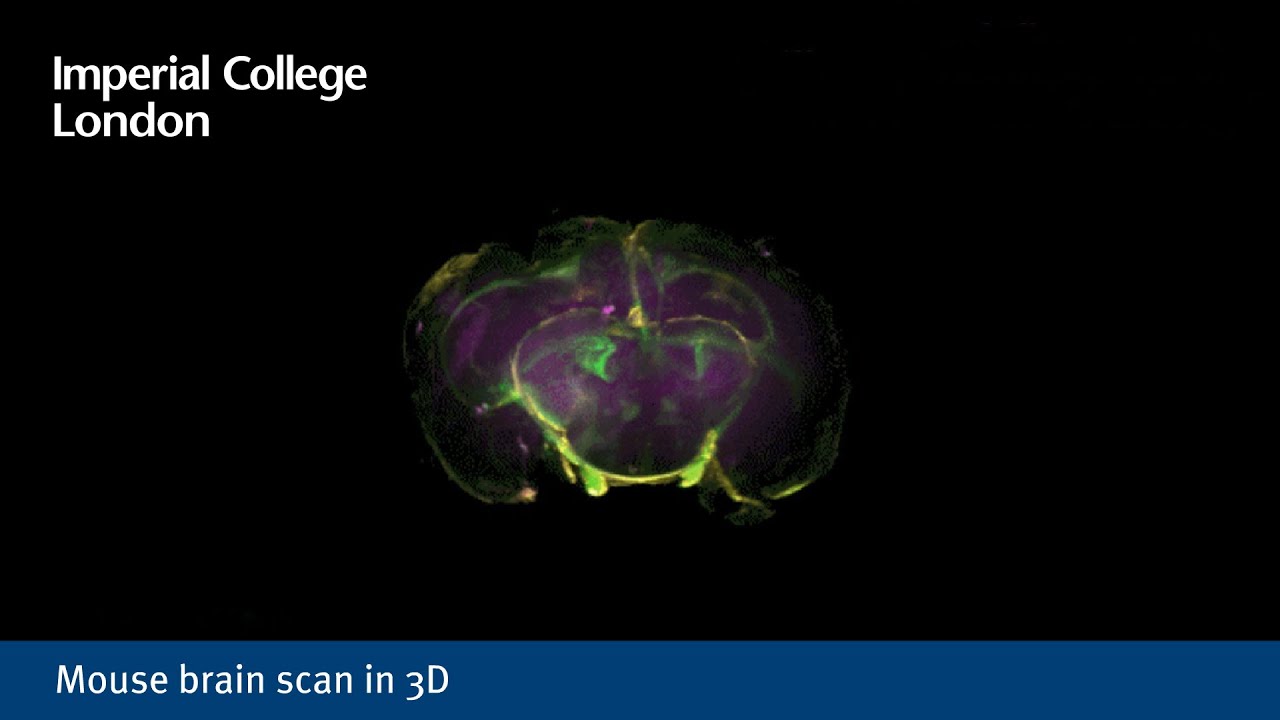 Mouse brain scan in 3D