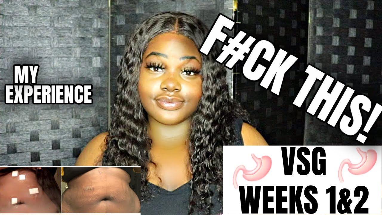 (VSG) JOURNEY WEEK 1&2 | WHAT THEY DON'T TELL YOU ABOUT VERTICAL SLEEVE GASTRECTOMY