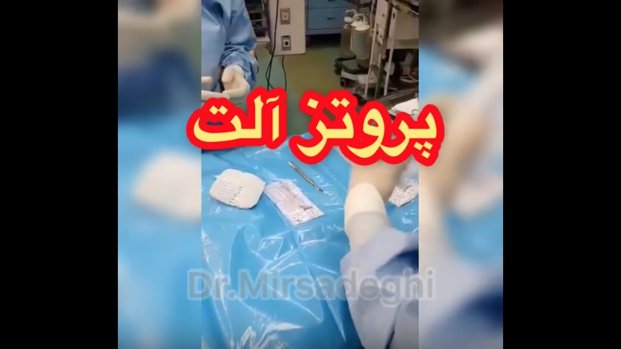 پروتز آلت  ( جراحی درمان عدم نعوظ ) - دکتر سید امین میرصادقی