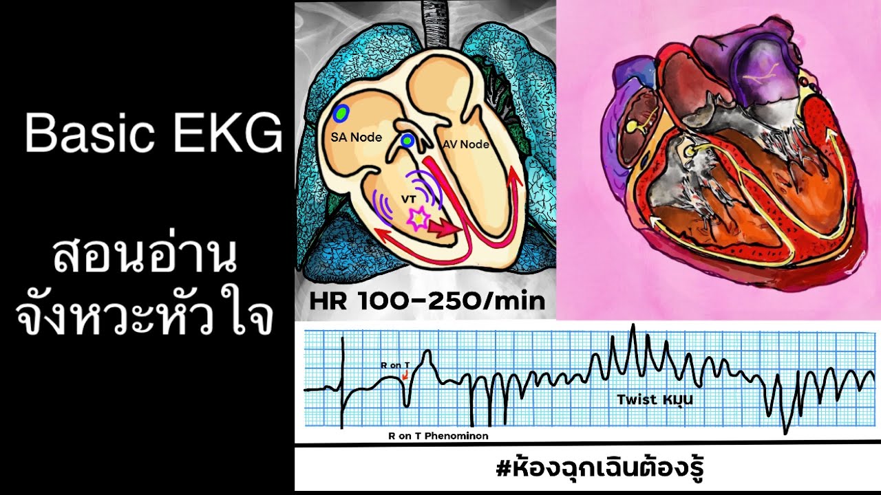 สอนอ่านพื้นฐานEKG:จังหวะหัวใจ Rhythm