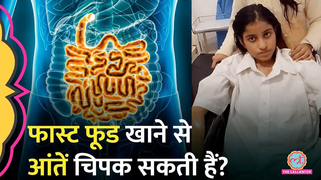 Amroha में ज़्यादा Fast Food खाने से गई 16 साल की लड़की जान, AIIMS में भर्ती थी